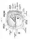 Fig. 13 - Implantable tissue stimulating electrode assembly
