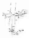 Fig. 08 - EMBOLIC PROTECTION SYSTEMS FOR BIFURCATED CONDUITS