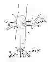 Fig. 09 - EMBOLIC PROTECTION SYSTEMS FOR BIFURCATED CONDUITS