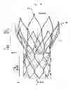 Fig. 04 - System for loading a collapsible heart valve