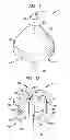 Fig. 05 - System for loading a collapsible heart valve