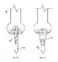Fig. 04 - PERCUTANEOUSLY DELIVERABLE VALVES