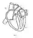 Fig. 09 - PERCUTANEOUSLY DELIVERABLE VALVES