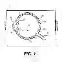 Fig. 02 - Modular intraocular lens designs and methods