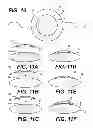 Fig. 08 - Modular intraocular lens designs and methods