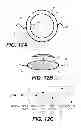 Fig. 09 - Modular intraocular lens designs and methods
