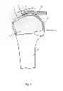 Fig. 02 - Arthroscopic method and apparatus for rotator cuff repair