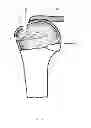 Fig. 07 - Arthroscopic method and apparatus for rotator cuff repair