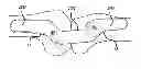 Fig. 01 - SHEATHS FOR EXTRA-ARTICULAR IMPLANTABLE SYSTEMS