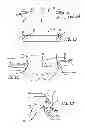 Fig. 02 - SHEATHS FOR EXTRA-ARTICULAR IMPLANTABLE SYSTEMS