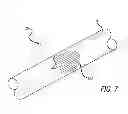Fig. 07 - SHEATHS FOR EXTRA-ARTICULAR IMPLANTABLE SYSTEMS