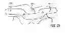 Fig. 22 - SHEATHS FOR EXTRA-ARTICULAR IMPLANTABLE SYSTEMS