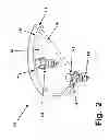Fig. 03 - RIM ANCHORING SYSTEMS FOR FLEXIBLE SURGICAL IMPLANTS FOR REPLACING CARTILAGE