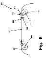 Fig. 06 - RIM ANCHORING SYSTEMS FOR FLEXIBLE SURGICAL IMPLANTS FOR REPLACING CARTILAGE