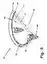 Fig. 08 - RIM ANCHORING SYSTEMS FOR FLEXIBLE SURGICAL IMPLANTS FOR REPLACING CARTILAGE