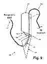 Fig. 09 - RIM ANCHORING SYSTEMS FOR FLEXIBLE SURGICAL IMPLANTS FOR REPLACING CARTILAGE