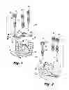 Fig. 02 - Orthopedic implants with flexible screws