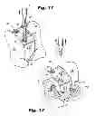 Fig. 07 - Orthopedic implants with flexible screws