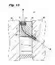 Fig. 08 - Orthopedic implants with flexible screws