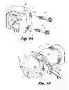 Fig. 09 - Orthopedic implants with flexible screws