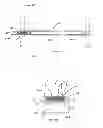 Fig. 08 - Methods for facet joint treatment