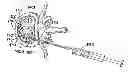 Fig. 01 - Spinal tissue distraction devices