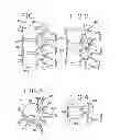 Fig. 02 - Spinal tissue distraction devices