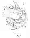 Fig. 02 - Knee joint prosthesis system and method for implantation