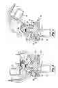 Fig. 04 - Knee joint prosthesis system and method for implantation
