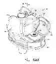 Fig. 06 - Knee joint prosthesis system and method for implantation