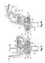 Fig. 08 - Knee joint prosthesis system and method for implantation