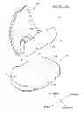 Fig. 01 - ARTIFICIAL KNEE JOINT