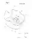 Fig. 02 - ARTIFICIAL KNEE JOINT