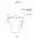 Fig. 09 - Method and apparatus for performing an open wedge, high tibial osteotomy