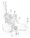 Fig. 28 - Method and apparatus for performing an open wedge, high tibial osteotomy