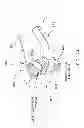 Fig. 33 - Method and apparatus for performing an open wedge, high tibial osteotomy