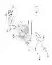 Fig. 41 - Method and apparatus for performing an open wedge, high tibial osteotomy