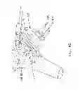 Fig. 49 - Method and apparatus for performing an open wedge, high tibial osteotomy