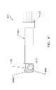 Fig. 50 - Method and apparatus for performing an open wedge, high tibial osteotomy