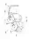Fig. 64 - Method and apparatus for performing an open wedge, high tibial osteotomy