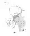 Fig. 02 - METHOD AND SYSTEM FOR ALIGNING A PROSTHESIS DURING SURGERY
