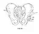 Fig. 06 - METHOD AND SYSTEM FOR ALIGNING A PROSTHESIS DURING SURGERY