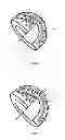 Fig. 04 - Artificial hip joint consisting of multi-layer shell core composite structural components