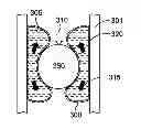 Fig. 01 - Endolumenal esophageal restriction device