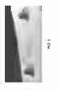 Fig. 09 - Elongated tissue matrices