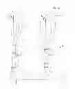 Fig. 02 - LEG PROSTHESIS