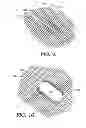 Fig. 08 - Three-dimensional weaving system