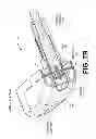 Fig. 10 - Dual flush handle control