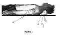 Fig. 03 - Orthotic device