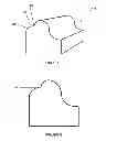 Fig. 04 - Orthotic device